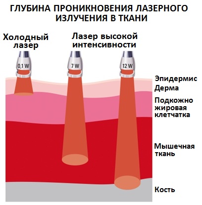 На рисунке представлены эффекты высокоинтенсивного лазерного излучения на биологические ткани где